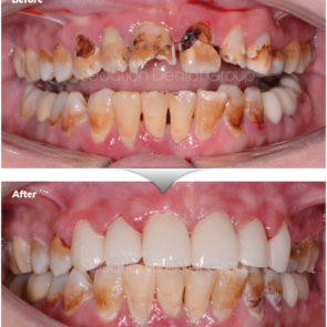 bna_sedation_dental_complicated_01