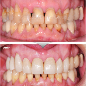 bna_sedation_dental_complicated_02