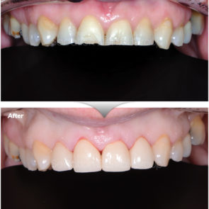bna_sedation_dental_complicated_03