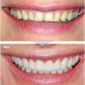 bna_sedation_dental_complicated_04