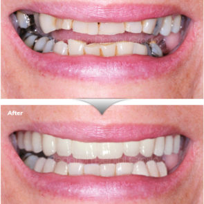 bna_sedation_dental_complicated_05