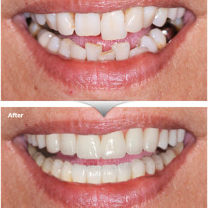 bna_sedation_dental_complicated_06