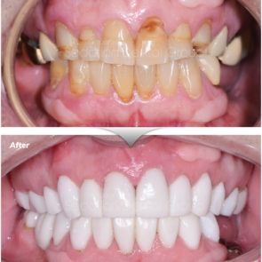 bna_sedation_dental_complicated_07