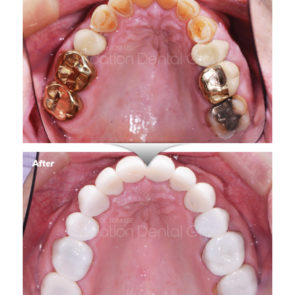bna_sedation_dental_complicated_08
