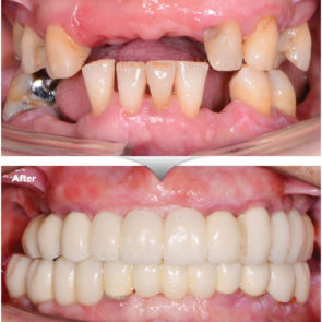 bna_sedation_dental_complicated_09