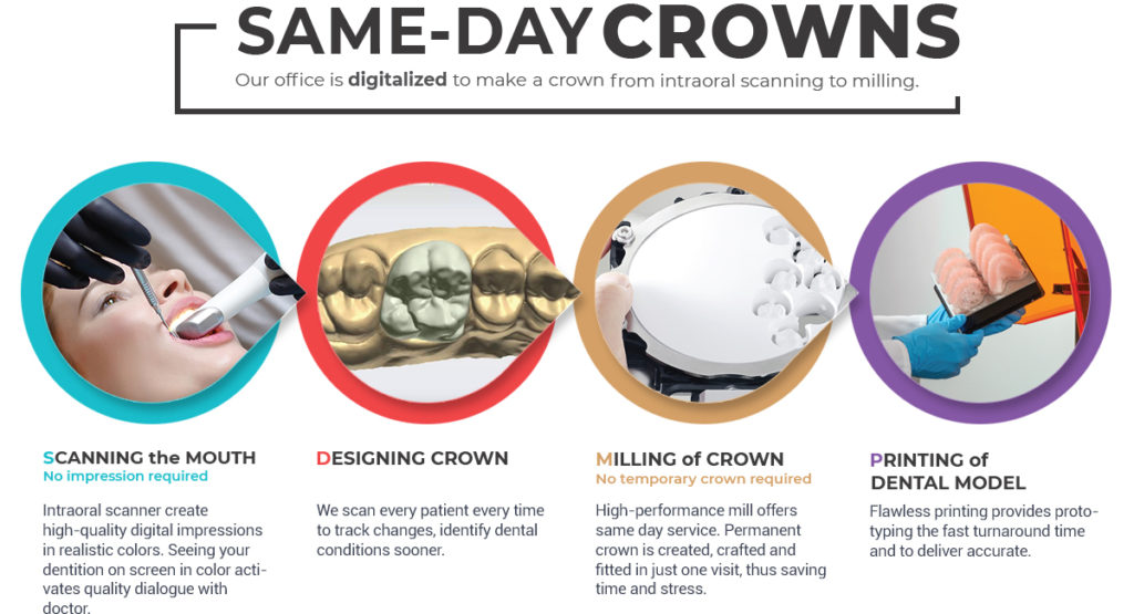 Same Day Crowns Near Me – Get Perfect Dental Restorations Faster